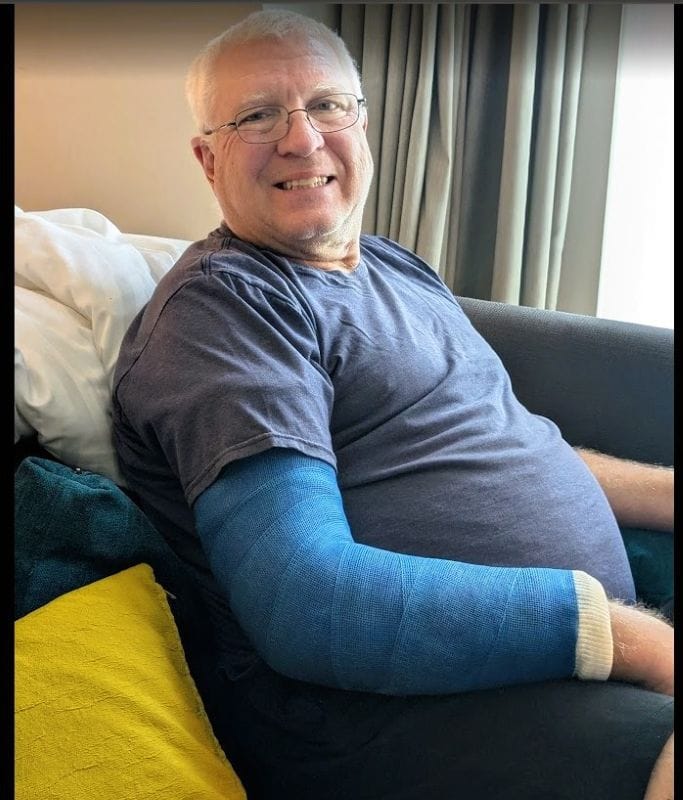 Here is my flexible travel cast I wore this on my plane trip from London to Dublin. From FoxRVTravel My crash landing in London.