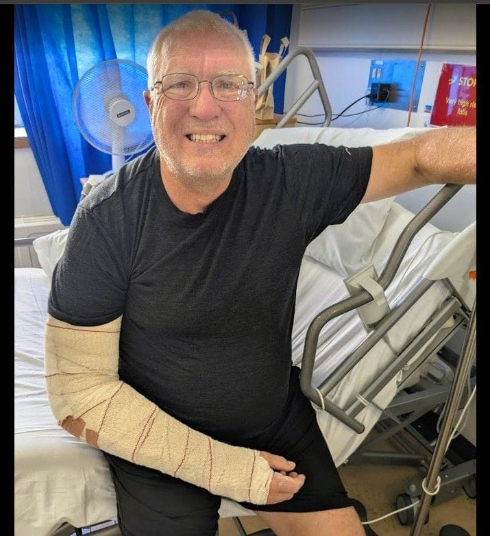 I am actually happy in this photo after my surgery. I expected a full cast. Instead I have a removable splint. From FoxRVTravel My crash landing in London.